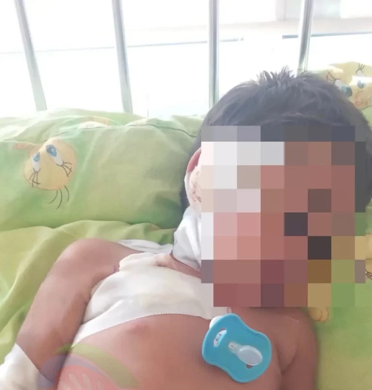 Fëmija 1 vjeç e gjysmë kafshohet nga qeni në oborrin e shtëpisë në Shuto Orizare